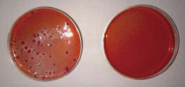 サンシルバー 大腸菌 デオキシコール酸塩 カンテン培地 テスト 製造直後
